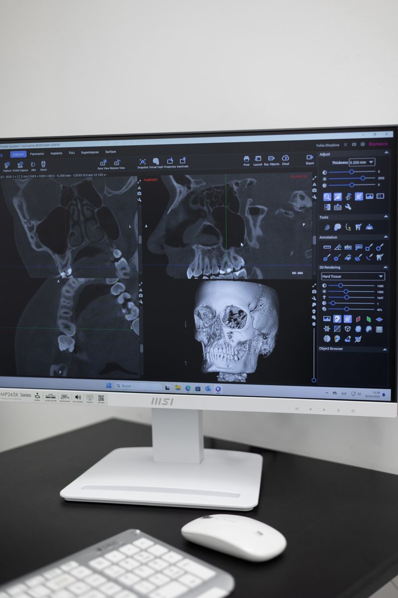 Компьютерный томограф: 3D-снимок до начала лечения